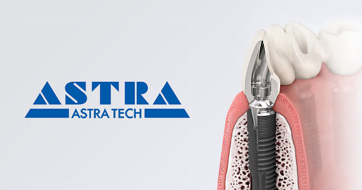 Astra Tech