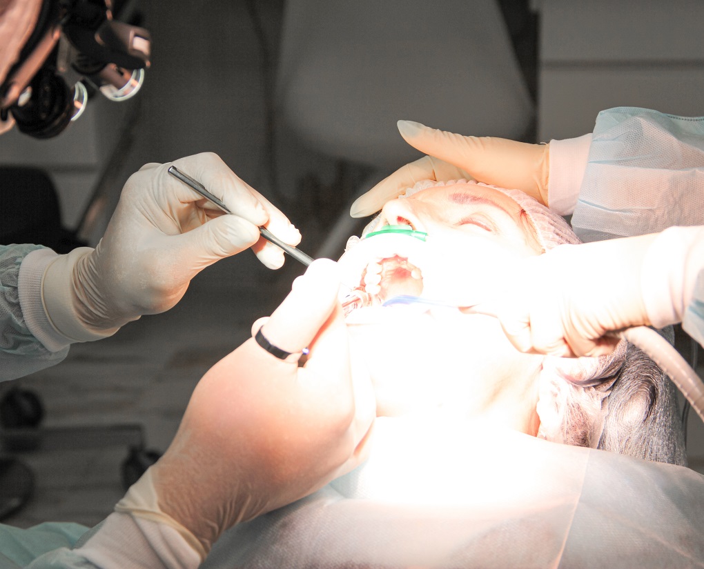 Использование седации в стоматологии Эстетус