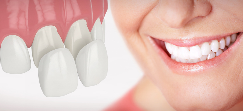 Можно ли протезировать зубы без обточки